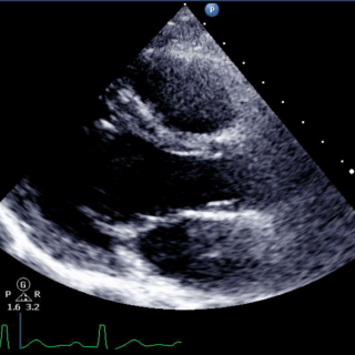 2026 EDW Echo Education Conference (RSS) Banner